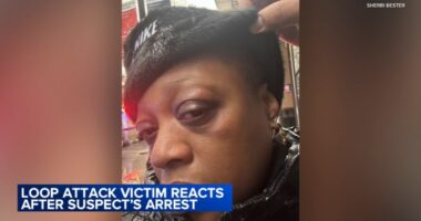 Loop puncher Chicago news: Marlon Miller ordered detained after alleged attacks, some while wearing ankle monitor, officials say