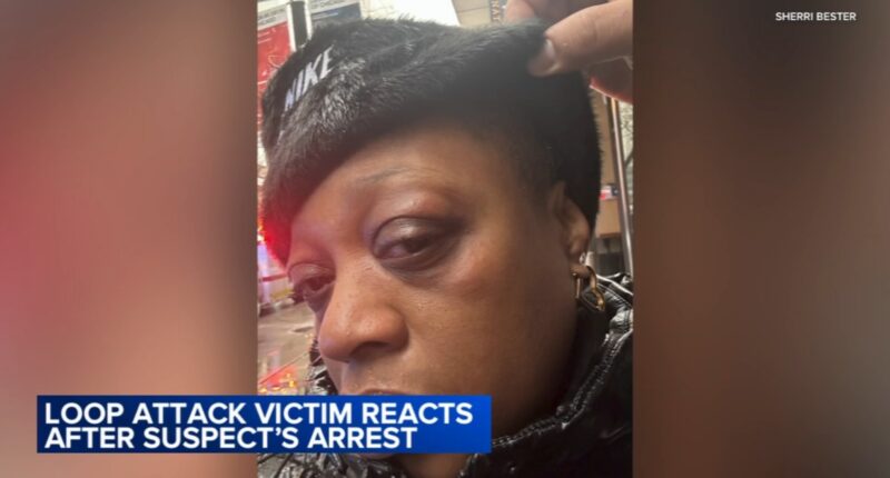 Loop puncher Chicago news: Marlon Miller ordered detained after alleged attacks, some while wearing ankle monitor, officials say