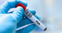 Men urged to ask their dad four key questions that could save his life