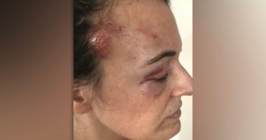 NYC ordered to pay $2.5M to George Floyd protestor in excessive force lawsuit