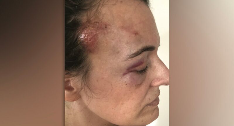 NYC ordered to pay $2.5M to George Floyd protestor in excessive force lawsuit