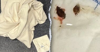 Virginia family alleges bed bugs bit them during transatlantic flight, suing Delta and KLM airlines