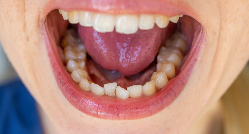 7 reasons you have a 'metallic ' taste in mouth and how to get rid of it