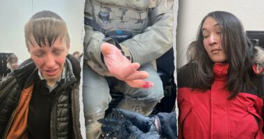 Anti-ICE agitator allegedly bites off federal officer's finger during Minneapolis attack