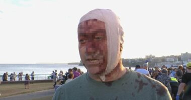 Bloodied and bandaged Bondi beach terror attack victim declares 'I lived through Oct 7th. Never imagined I'd see this horror in Australia'