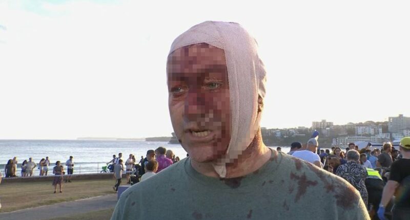 Bloodied and bandaged Bondi beach terror attack victim declares 'I lived through Oct 7th. Never imagined I'd see this horror in Australia'