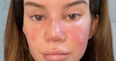 Country star suffered face-swelling 'sinus infection' before NYE show