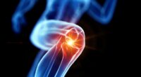 Do you suffer from crippling knee pain? Our experts reveal the stunning new treatments on the horizon that are side-effect free and could eliminate your agony for good