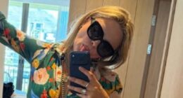 Emily Atack's dramatic transformation continues as she shows off her tummy in a cropped shirt and shorts