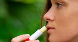 Everything that could be causing your dry lips... and what you can do to fix them: DR PHILIPPA KAYE