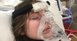 I spent months in a coma and nearly died from the flu... my cautionary tale as 'super' virus ravages US