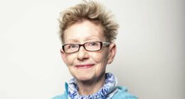 I was born with eczema but by my late 50s my bleeding, raw skin was falling away, I had fungal infections on my feet and my scalp was one big scab. Then a game-changing drug transformed my life in just two weeks