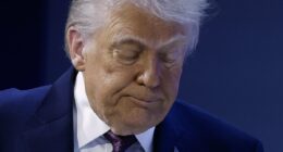 Karoline Leavitt gives extraordinary new reason for Trump's bruised hands