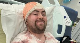 Man, 31, almost dies after 'running injury' turns out to be a sign of deadly brain cancer