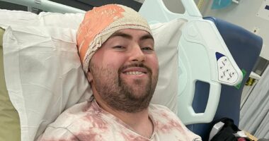 Man, 31, almost dies after 'running injury' turns out to be a sign of deadly brain cancer