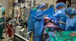 Man kept alive for 48 hours with lungs removed