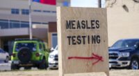 Measles cases surge in southern US as even vaccinated people get sick