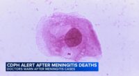 Meningococcal disease: 2 deaths, more cases that usual reported in meningitis outbreak, Chicago Department of Public Health warns