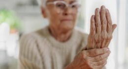 NHS alert to anyone taking common medication for osteoarthritis