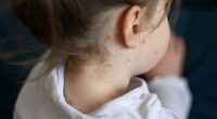 NHS breakthrough as it offers chickenpox vaccines for the first time