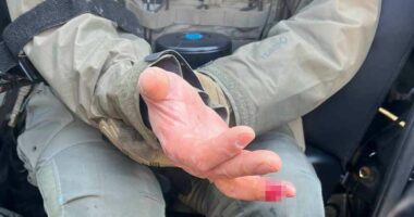 'Rioters bite off' officer's finger after deadly Minneapolis shooting