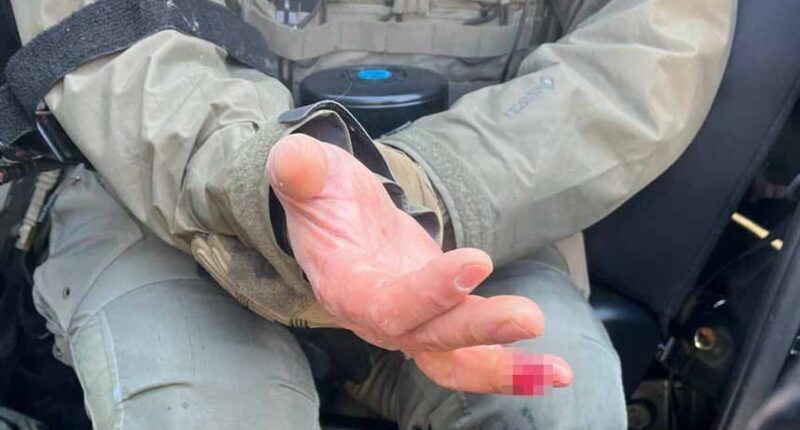 'Rioters bite off' officer's finger after deadly Minneapolis shooting