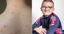 The chickenpox complication that left Roman in a wheelchair aged four