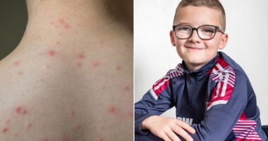 The chickenpox complication that left Roman in a wheelchair aged four