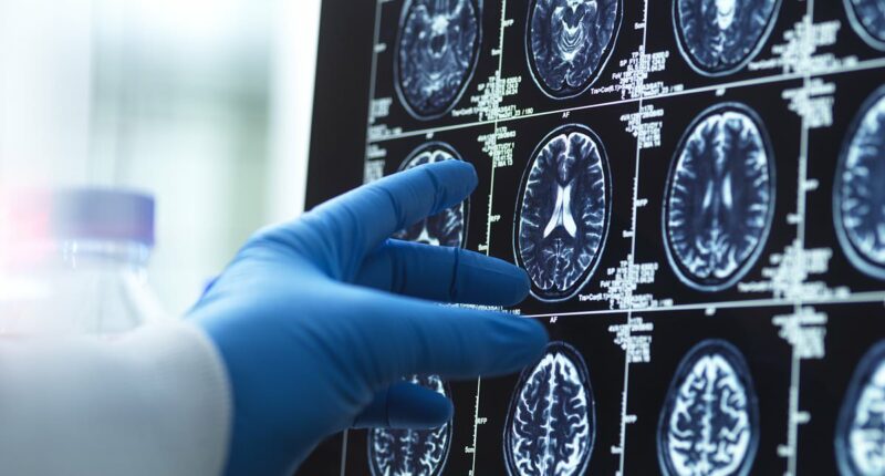 The size of your head can reveal your risk for devastating neurological disease