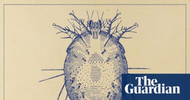 The sudden rise of scabies: ‘I wouldn’t wish it on my worst enemy’