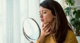 The surprising facial feature that can reveal if you will get dementia