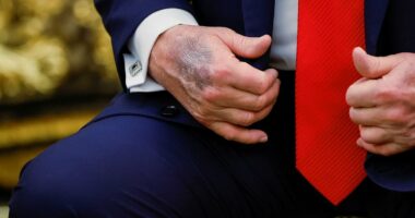 Trump blames hand bruises on high aspirin dose