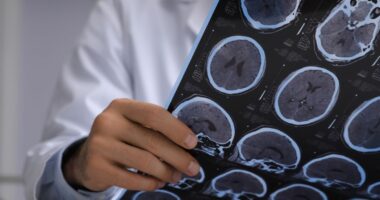 UK stroke victims could soar to over 400-a-day unless Labour step up prevention