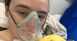 Why ARE so many young people getting thyroid cancer? As cases surge in under 40s, one sufferer says her symptoms were dismissed as 'hormones'