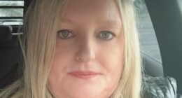 Woman, 48, with a kidney stone sent home by hospital - only to need all her fingers and toes AMPUTATED after going into septic shock