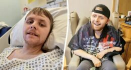 Young-onset dementia symptoms explained after death of Britain's youngest patient