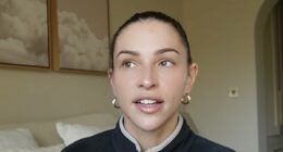 Zara McDermott reveals she has had her jaw filler dissolved