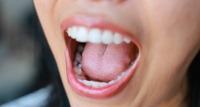 'I'm a doctor - a sore tongue and memory issues may be a sign of one deficiency'