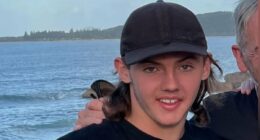 Australian teen dies from a red meat allergy after eating sausages