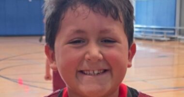 Boy terribly burned after taking part in TikTok MICROWAVE challenge