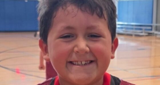 Boy terribly burned after taking part in TikTok MICROWAVE challenge