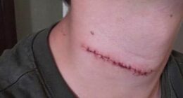 Daytona Beach police review handling of suspect in teen slashing case