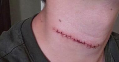 Daytona Beach police review handling of suspect in teen slashing case