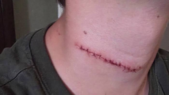 Daytona Beach police review handling of suspect in teen slashing case