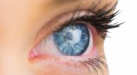 Experts pinpoint bacteria in the eyes that could drive dementia - discovery heralds treatment to PREVENT deadly condition