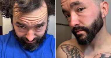 Hairless heroes! Inside the online community where balding men encourage one another to shave their heads - and heap praise on their astounding new looks