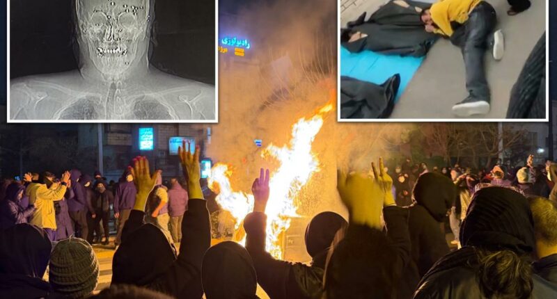 Horror at Iran hospital revealed after regime protest crackdown