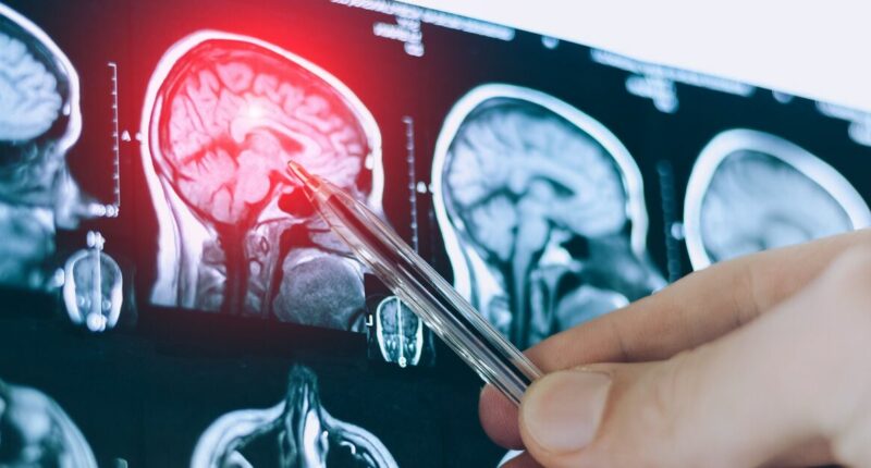 Huge dementia breakthrough as scientists make bombshell 'superagers' discovery
