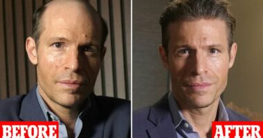 I was balding at 24 and couldn't stand the embarrassment. Then I discovered the treatment that works '100% of the time' and it transformed my life