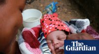 Influencers, misinformation and aid cuts: the fight to halt polio in Malawi